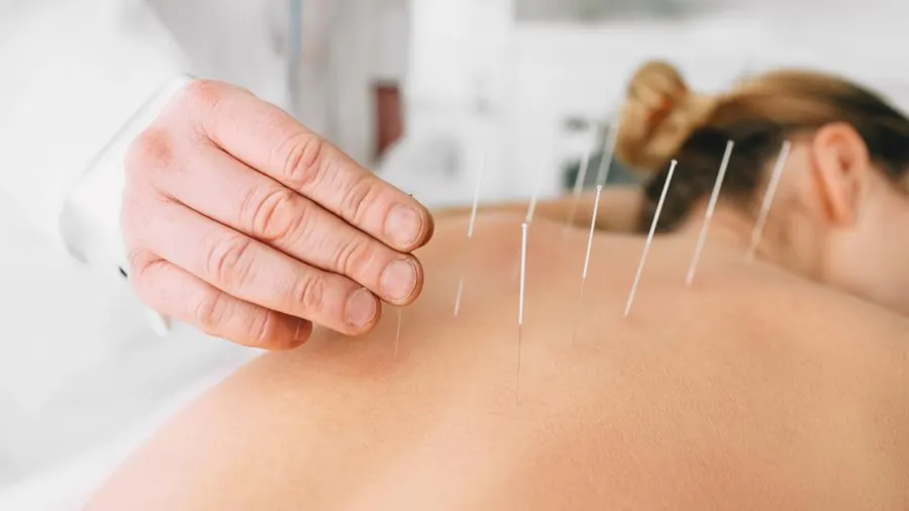 blog_image/Accupuncture.png