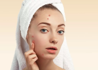 Skin Problems